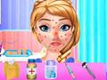 Jogo Tratamento da Alergia de Primavera da Anna online